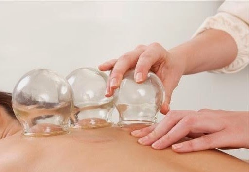Hijama Therapy is The Best Medicine